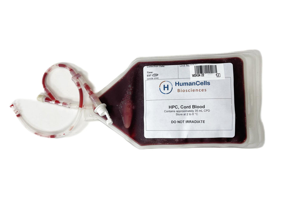 Buy Unprocessed Human Cord Blood. Fresh. Fast Shipping