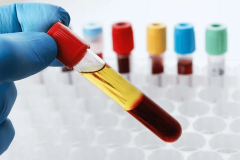 Human Healthy Donor Off-the-clot Serum