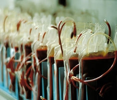 Unprocessed Fresh Human Cord Blood
