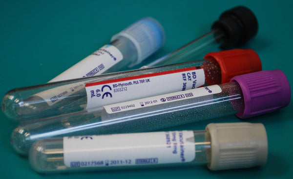 Graves Thyroid Disease Plasma And Whole Blood