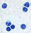human bone marrow mononuclear cells, BMMC, BM MNC