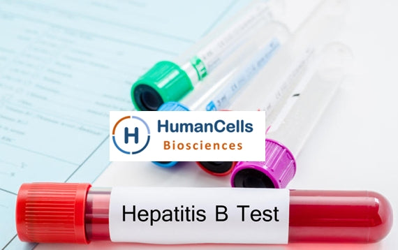 Hepatitis B (HBV) Patient Leuko Pak / Whole Blood / Plasma / Serum