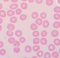 Human Normal Peripheral Blood Red Blood Cells / Mature Erythrocytes