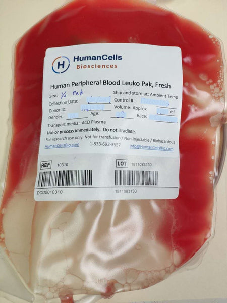 Human Normal Peripheral Blood Leuko Pak (leukopak), PBMC